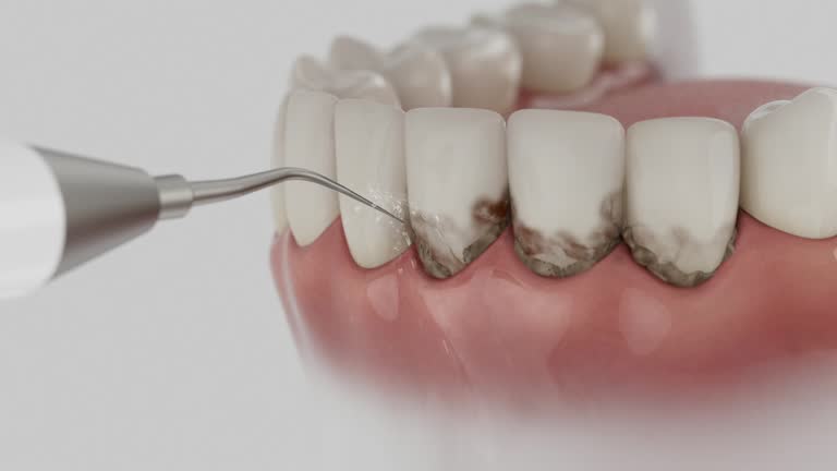 Trusted Teeth Cleaning And Checkup service in Kerman, CA - Dentist Open Now
